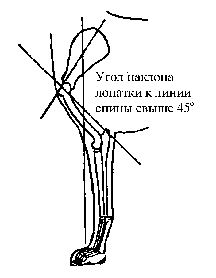 Стандарт породы САМОЕД: Неправильное положение плеча