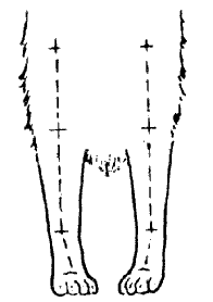Стандарт породы САМОЕД: Косолапость